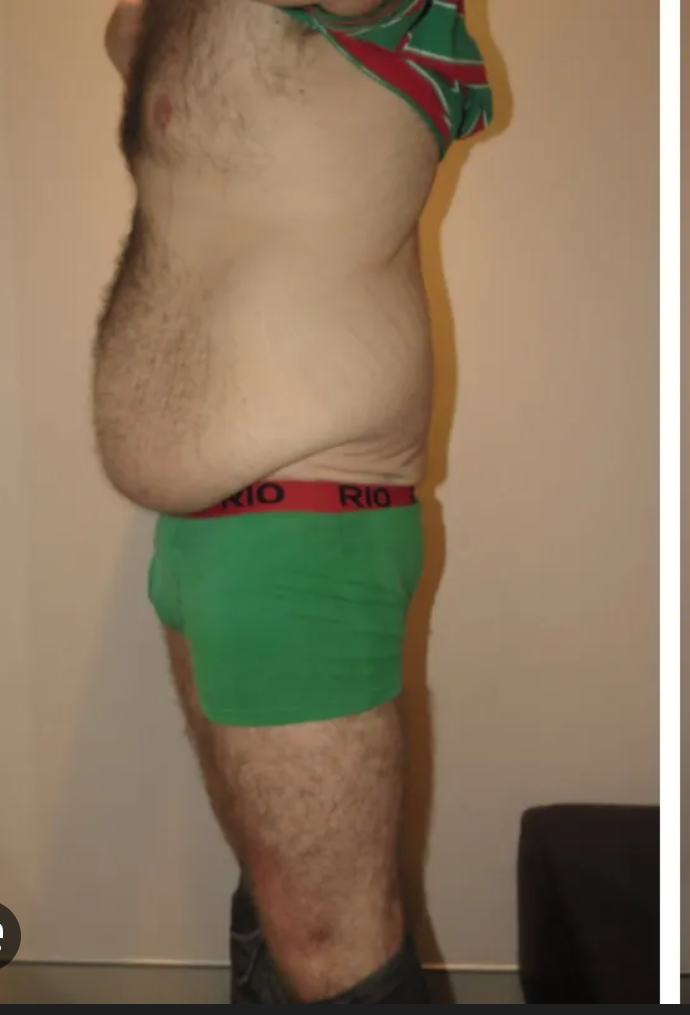 Midsection before — higher waistline