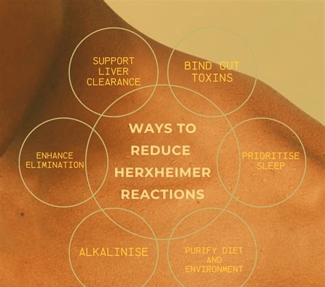 Herxheimer reaction / cellular die-off (warm sepia treatment)